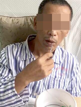 太神奇!不到一分钟,中风大叔淡定自行"插胃管"完成进食